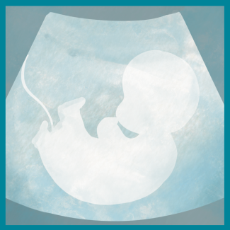 fetus-ultrasound-sketch